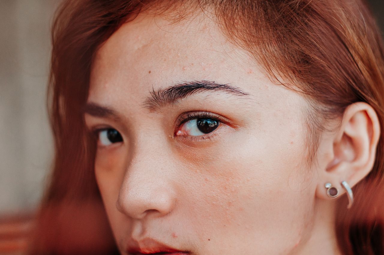Eye Infections & Styes — Symptoms, Causes & Same Day Treatment